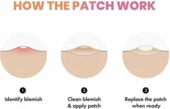 Beste deal ✔️ Merkloos Pimple Patch - Acne Patch - Puisten Patch - Acne Sticker - Puisten Pleister - Pimple Patches - Acne Pleister - Puisten Verwijderaar - Puisten Creme - Acne Verwijderen Set - Acneverzorging | 36 Stuks & Directe Levering 🛒 -Beauty Winkel 550x352 1