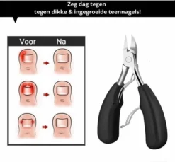 Groothandel 👍 Enjoy Living Vlijmscherpe Nageltang Met Gebogen Bek - Voor Knippen Harde / Dikke & Ingegroeide Teennagels - Teennagelknipper - Teennagelschaar - 4-delige Manicureset Professioneel - Manicure Set - Pedicureset 🤩 24 Groothandel 👍 Enjoy Living Vlijmscherpe Nageltang Met Gebogen Bek - Voor Knippen Harde / Dikke & Ingegroeide Teennagels - Teennagelknipper - Teennagelschaar - 4-delige Manicureset Professioneel - Manicure Set - Pedicureset 🤩 -Beauty Winkel 550x509 10