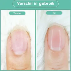 Goedkoop 🔥 Christian Deluxe - Baby Nagelknipper Groen - Baby Manicureset - Baby Verzorgingsset - Baby Nagelvijl - Baby Nagelschaartje - Baby Nagelset - Elektrisch ⌛ 12 Goedkoop 🔥 Christian Deluxe - Baby Nagelknipper Groen - Baby Manicureset - Baby Verzorgingsset - Baby Nagelvijl - Baby Nagelschaartje - Baby Nagelset - Elektrisch ⌛ -Beauty Winkel 550x546 4