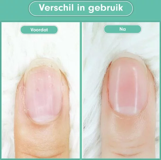 Goedkoop 🔥 Christian Deluxe - Baby Nagelknipper Groen - Baby Manicureset - Baby Verzorgingsset - Baby Nagelvijl - Baby Nagelschaartje - Baby Nagelset - Elektrisch ⌛ 6 Goedkoop 🔥 Christian Deluxe - Baby Nagelknipper Groen - Baby Manicureset - Baby Verzorgingsset - Baby Nagelvijl - Baby Nagelschaartje - Baby Nagelset - Elektrisch ⌛ - Afbeelding 4