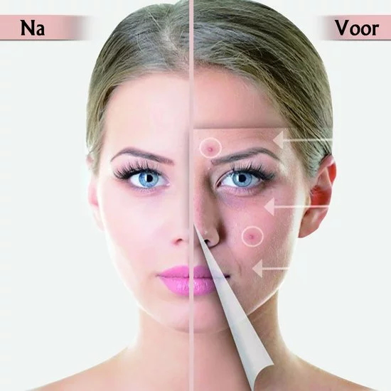 Goedkoopste π Novabeau Acne Patches Voor Dag En Nacht - Puisten Verwijderaar - Huidreiniger - 144 Stuks In 2 Formaten - Pukkel Pleister - Pimple Patch Die Onzuiverheden Absorbeert - Acneverzorging π 8 Goedkoopste π Novabeau Acne Patches Voor Dag En Nacht - Puisten Verwijderaar - Huidreiniger - 144 Stuks In 2 Formaten - Pukkel Pleister - Pimple Patch Die Onzuiverheden Absorbeert - Acneverzorging π - Afbeelding 6