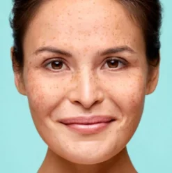 Flash-uitverkoop 🧨 Biodermal Pigmentvlekken Cr Me - SPF 15 - Vermindert Pigmentvlekken - Pigmentvlekken Creme - 50 Ml 🎉 -Beauty Winkel 550x552 22