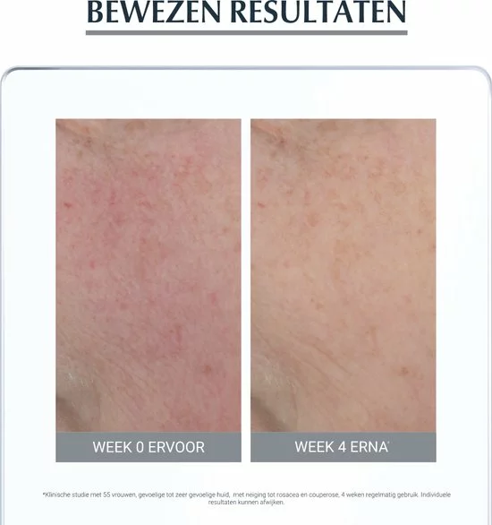 Beste Verkoop β Eucerin Anti-redness Kalmerend - Dagcr Me - 50 Ml π 9 Beste Verkoop β Eucerin Anti-redness Kalmerend - Dagcr Me - 50 Ml π - Afbeelding 7