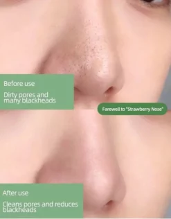 Beste deal π Sidas Green Mask Stick - Green Mask - 100% Natuurlijk Detox Masker - Gezichtsmasker - Masker - Verzorging - Verzachtend - Groene Thee - Huidverzorging β¨ 9 Beste deal π Sidas Green Mask Stick - Green Mask - 100% Natuurlijk Detox Masker - Gezichtsmasker - Masker - Verzorging - Verzachtend - Groene Thee - Huidverzorging β¨ -Beauty Winkel 550x704 4